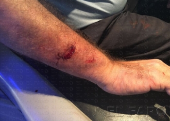 fotosceuta 2016 06 14 Manuel Melilla IMG 20160613 WA0003 La COA suspende la línea 6 tras el ataque con un machete a uno de sus conductores