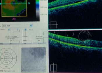 Foto3 Ciencia ‘local’ para la pérdida de visión