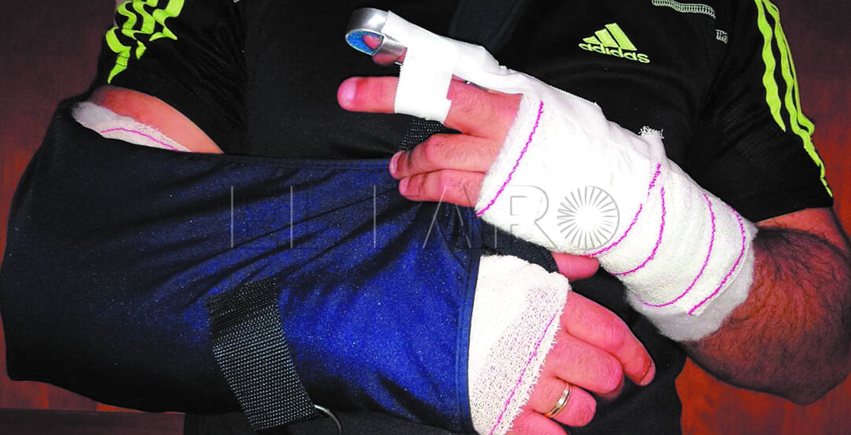 El policía herido en Farhana estará un mes de baja y aún buscan al conductor ‘kamikaze’