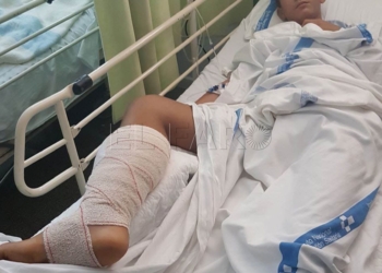 13 1 11 Un menor denuncia que fue agredido por un guardia en el puerto de Melilla: estuvo varios días hospitalizado