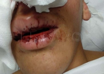 15 1 3 Un grupo de policías fuera de servicio, denunciado por agredir a un joven melillense