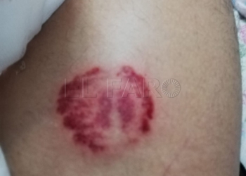 7 260219 Un futbolista, su padre y su hermano agreden a un árbitro asistente
