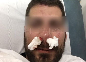 policia agredido Un grupo de unos 15 menores agrede a un policía nacional en la plaza de la Cruz Roja