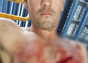 Autolesionado OK Un individuo se autolesiona con una botella rota en la frontera de Barrio Chino