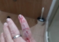 WhatsApp Image 2022 02 21 at 22.50.09 Paz Velázquez anima a las víctimas de un perro sospechoso de rabia a denunciar a Salud Pública